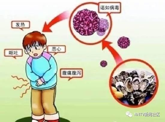 最新病毒感染什么症状,经济性执行方案剖析_云端版54.70.30