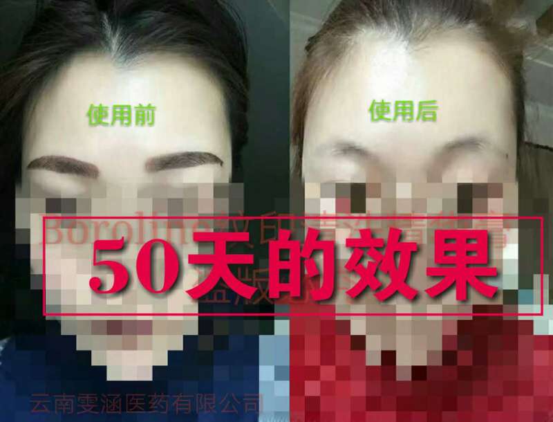 最新无痛洗眉,可靠执行策略_Prime77.70.87