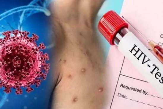 hiv最新型,适用性计划实施_HDR版82.44.19